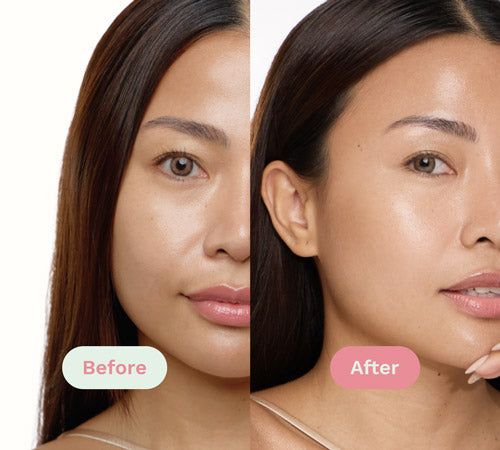 Before/After image