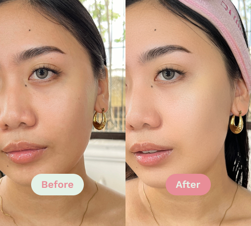 Before/After image