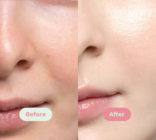 Before/After image