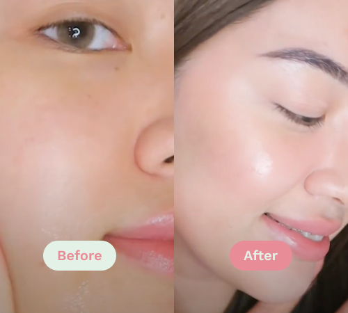 Before/After image