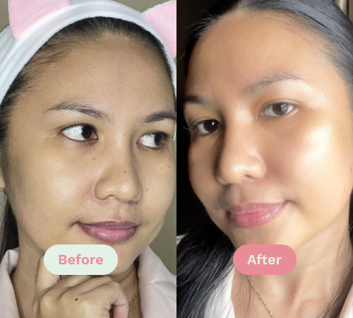 Before/After image