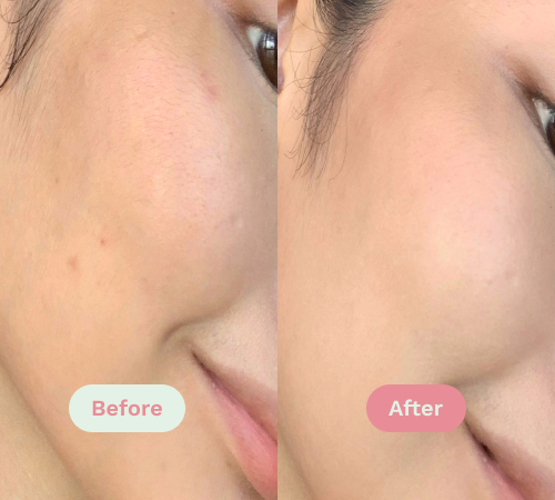Before/After image
