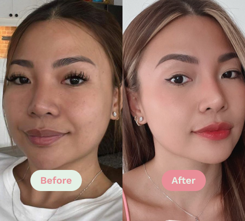 Before/After image
