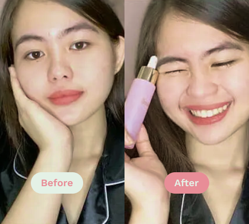 Before/After image