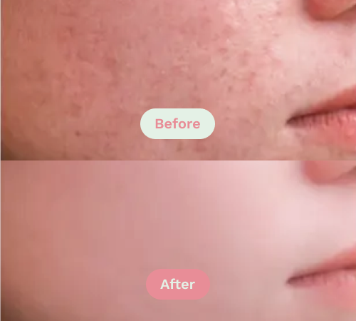 Before/After image